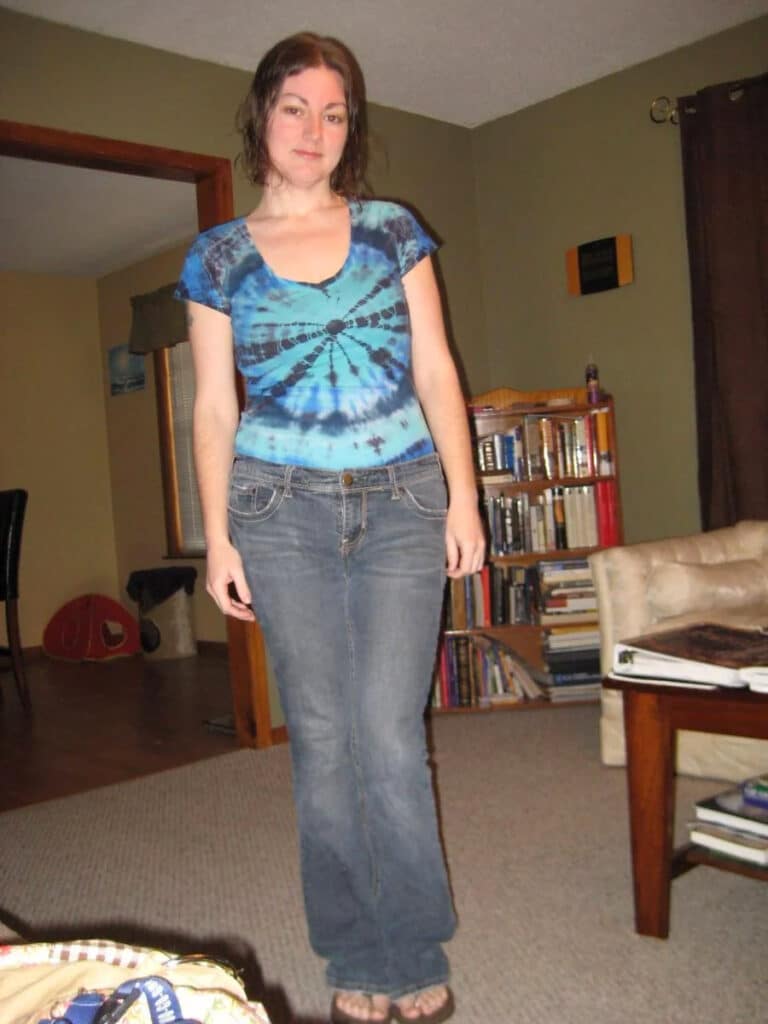 After weight loss